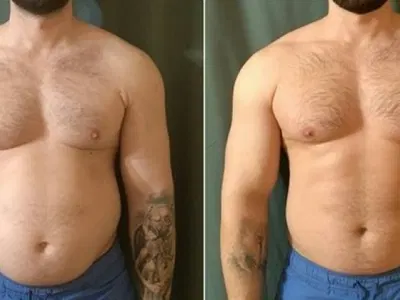 ResveraBurn customer review from Alice age 31 weight loss results